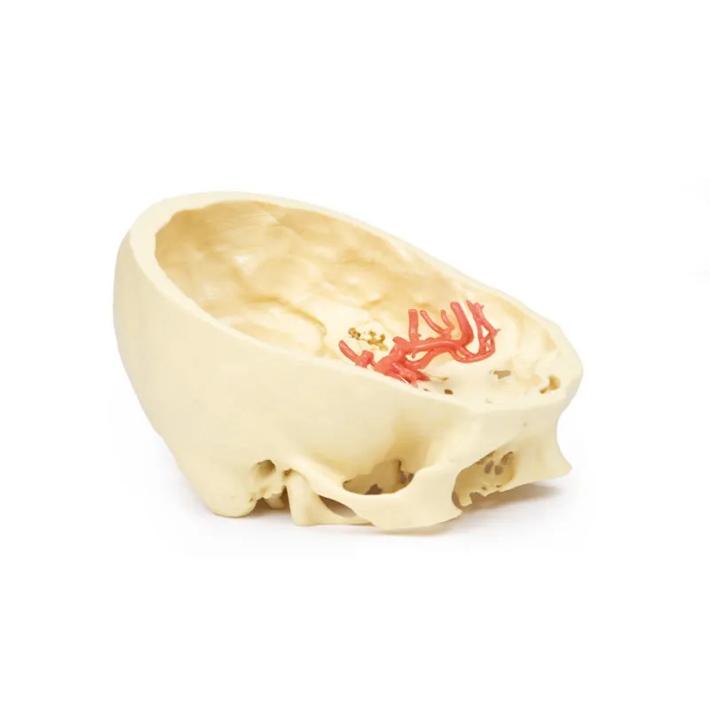 3D Printed Circle of Willis