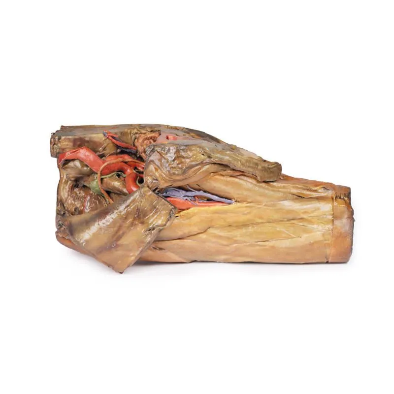 3D Printed Male Hemipelvis and Thigh