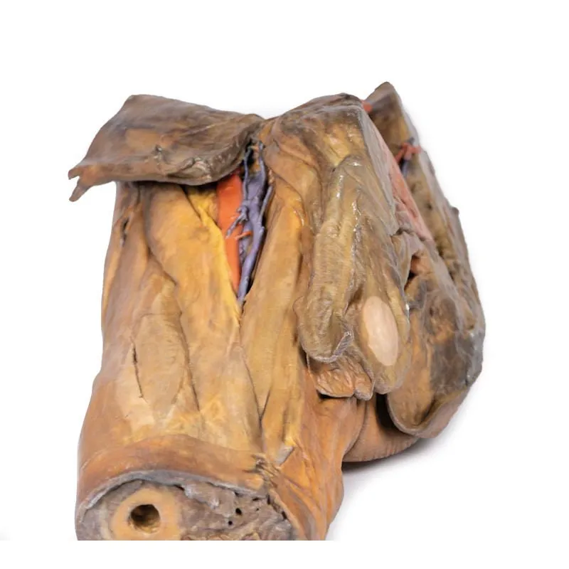3D Printed Male Hemipelvis and Thigh