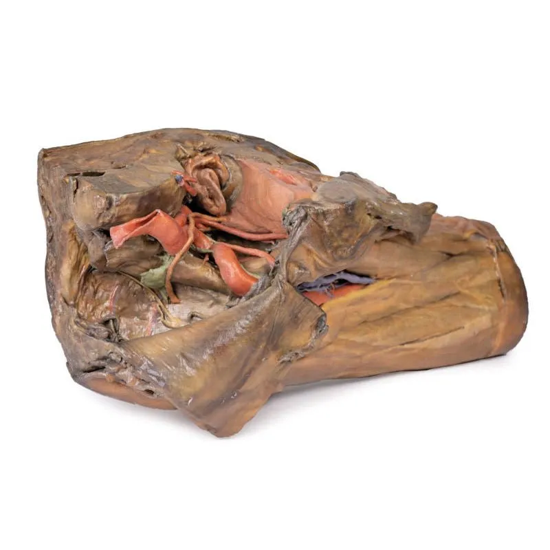 3D Printed Male Hemipelvis and Thigh