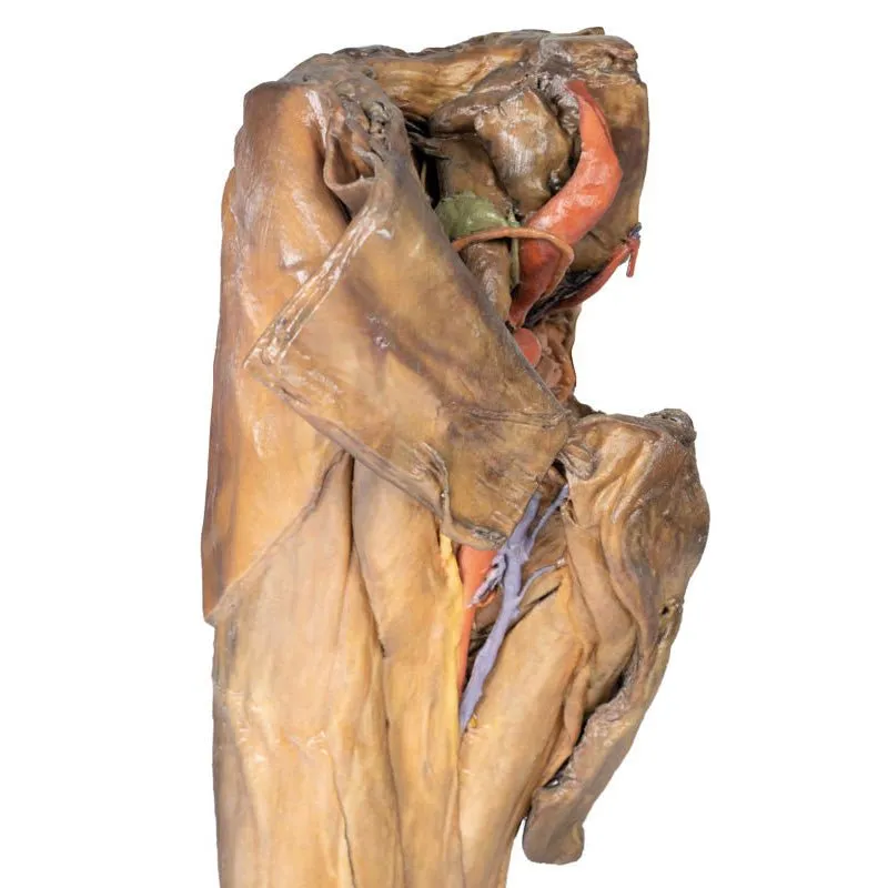 3D Printed Male Hemipelvis and Thigh